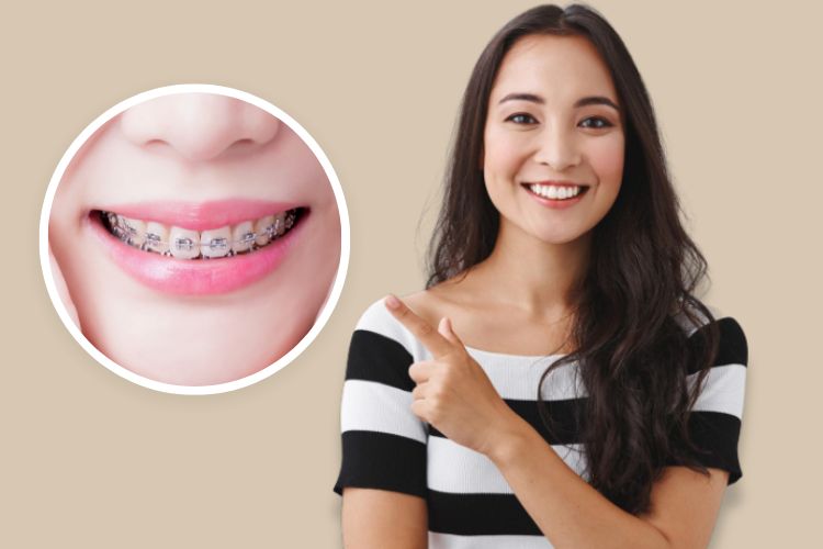 braces treatment image 