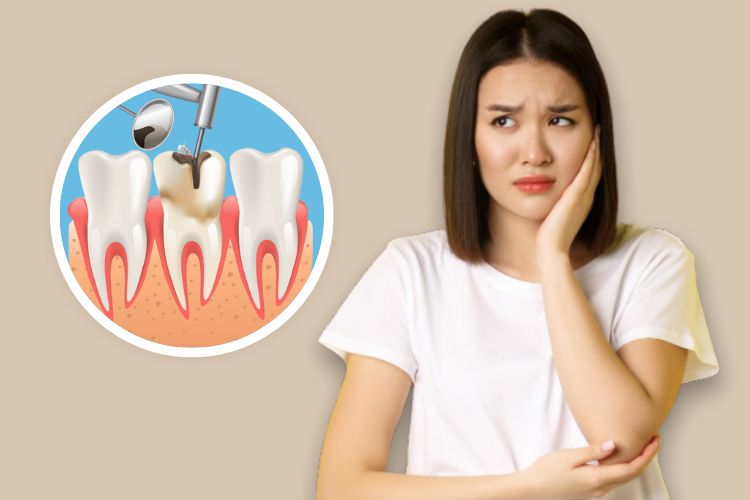 root canal treatment image 