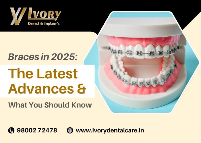 braces-in-2025-the-latest-advances-and-what-you-should-know