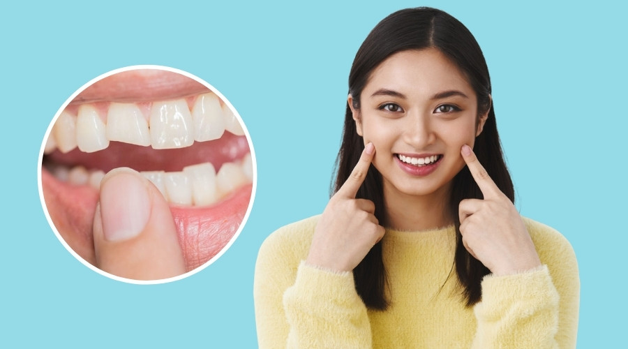 Cosmetic Dental Treatment in Gangtok