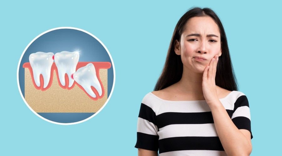 Wisdom Tooth Removal Treatment in Gangtok 